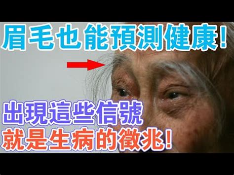 白眉毛可以拔嗎|白眉毛拔除5大招!白眉毛拔除竟可讓你年輕10歲!